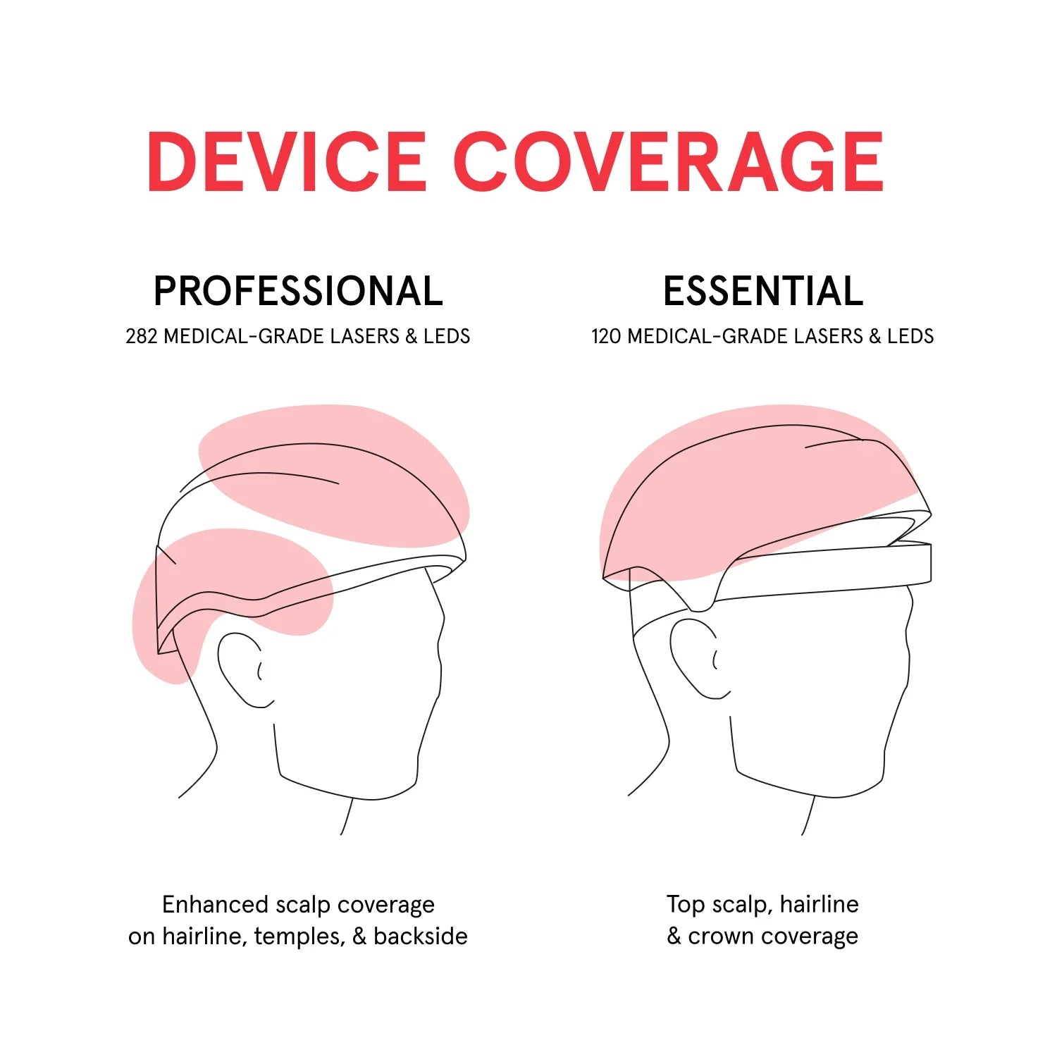 An image comparing the Professional hair device with Essential hair device. The Professional has 282 medical-grade lasers and LEDs while the Essential has 120 medical-grade lasers and LEDs. On the other hand, the Professional has enhanced scalp coverage on hairline, temples and backside of the scalp while the coverage of Essential is only limited to top scalp, hairline and crown.