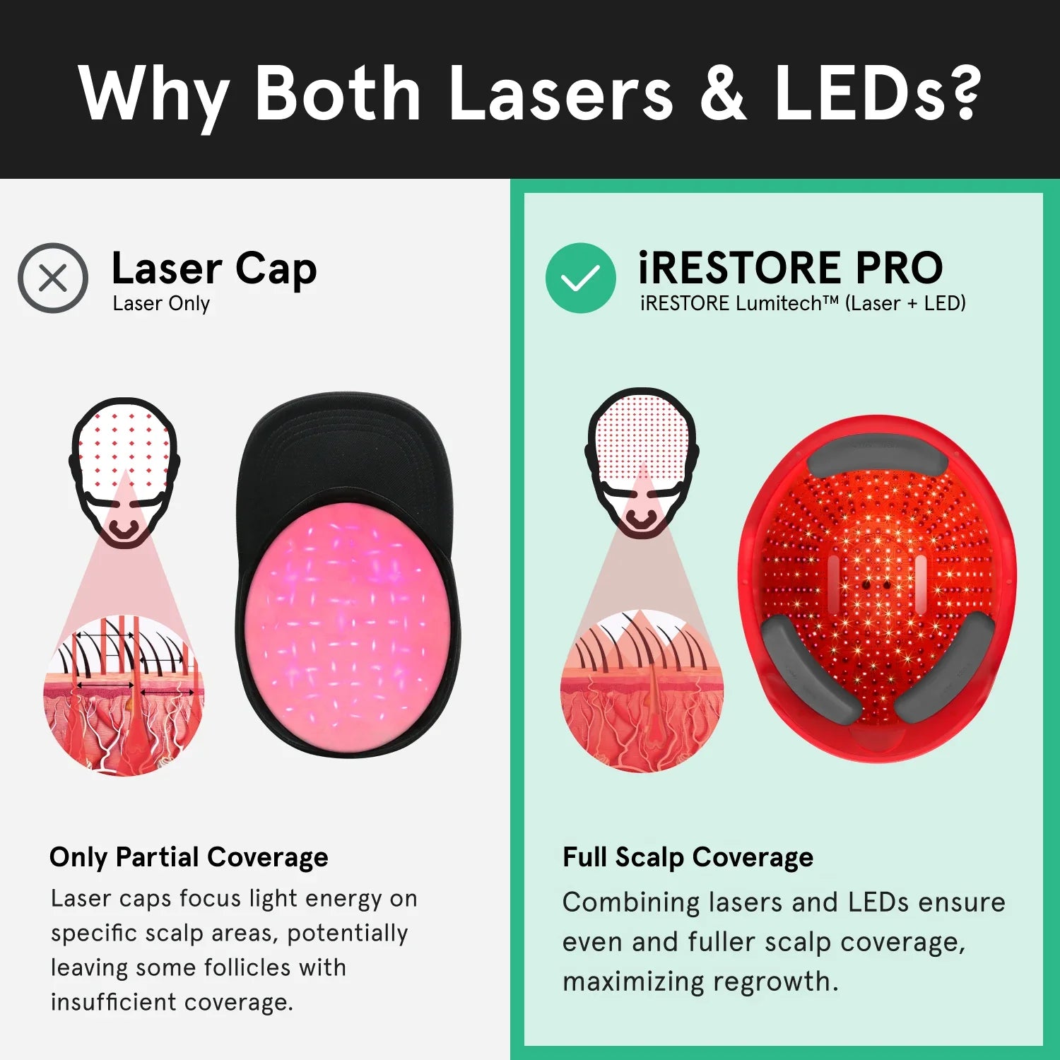 An image comparing the iRESTORE Professional with other laser cap. Laser caps only have partial coverage, laser caps focus light energy on specific scalp areas, potentially leaving some follicles with insufficient coverage. While the Professional device have full scalp coverage, combining lasers and LEDs ensure even and fuller scalp coverage, maximizing regrowth.